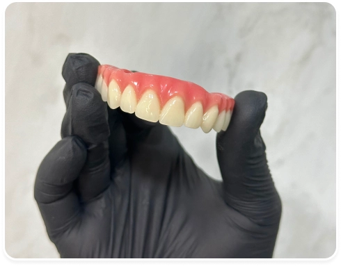 implantes-e-protocolos-risoarte-dentista-cambuci-mooca-sp 1