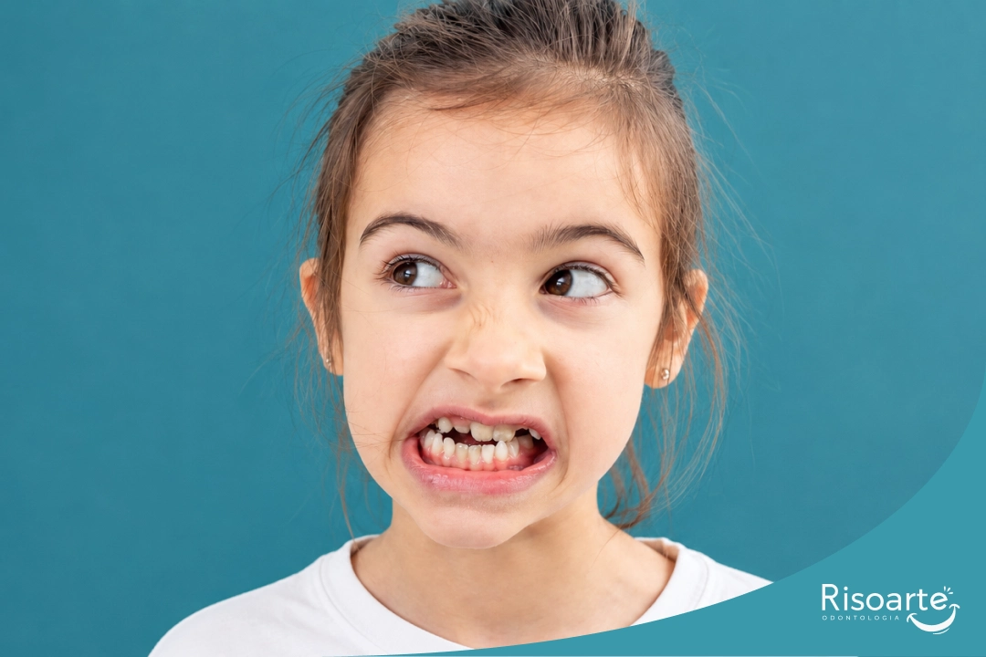 Criança mostrando os dentes durante o desenvolvimento infantil com sinais de Bruxismo.