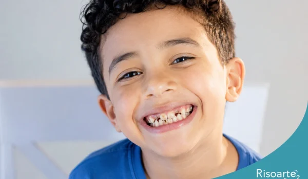 Criança sorrindo com dentes de leite escurecidos e manchas escuras que podem indicar cárie.